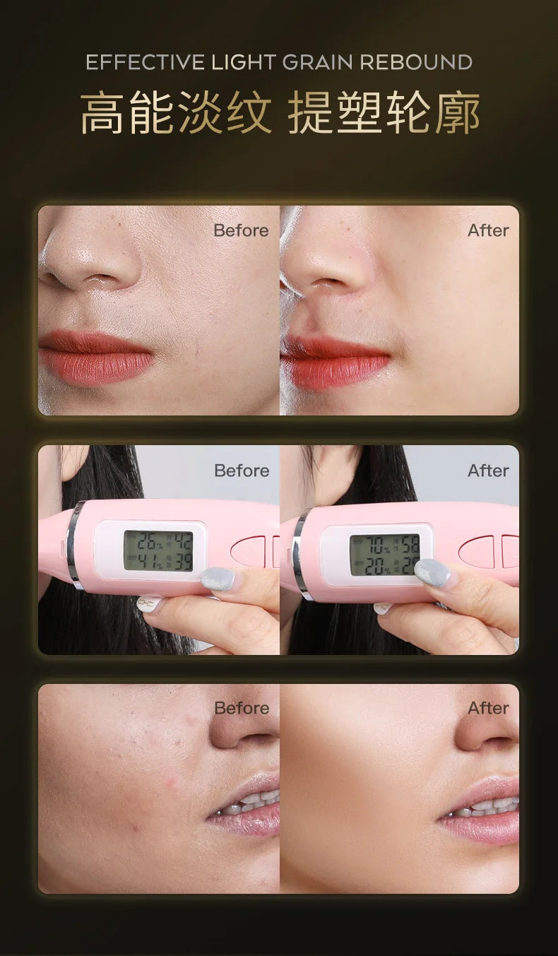 MERCILEN Youth Freeze Solution Firming Wrinkles Moisturizing And Moisturizing Facial Serum Anti-Dullness Facial Treatment 120ml