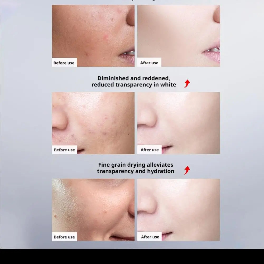 1/2pcs Mercilen 377 VC Essence Oil Facial Care Tightening Moisturizing Brightening Face Serum Korean skin care products